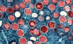 Mpox Outbreak: A Global Concern