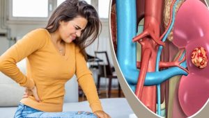Early Signs of Kidney Disease: Pay Attention to Your Body